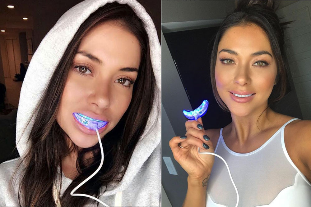 3 Celebrity Teeth whitening sensitivity hacks and 6 Celebrity teeth whitening hacks