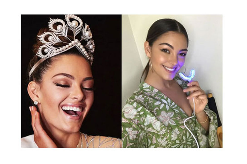 You are currently viewing 6 Celebrity teeth whitening hacks