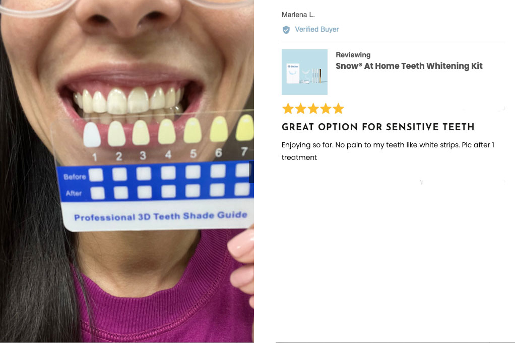 Snow teeth whitening kit Customers