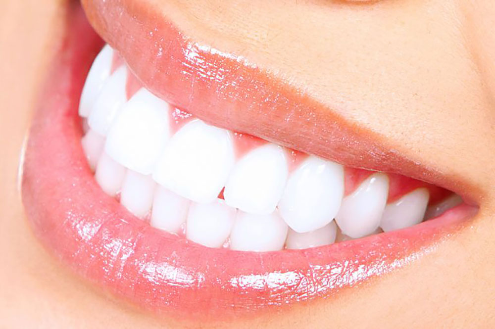 Teeth whitening hacks
