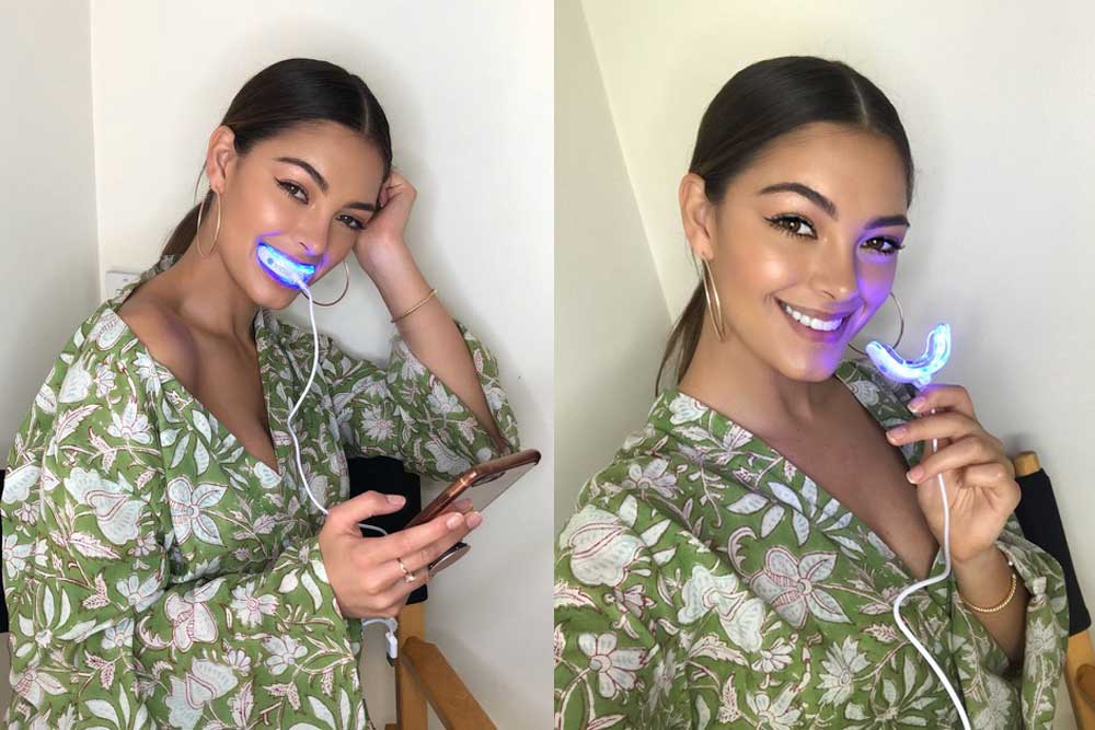 The Best Teeth whitening to buy now